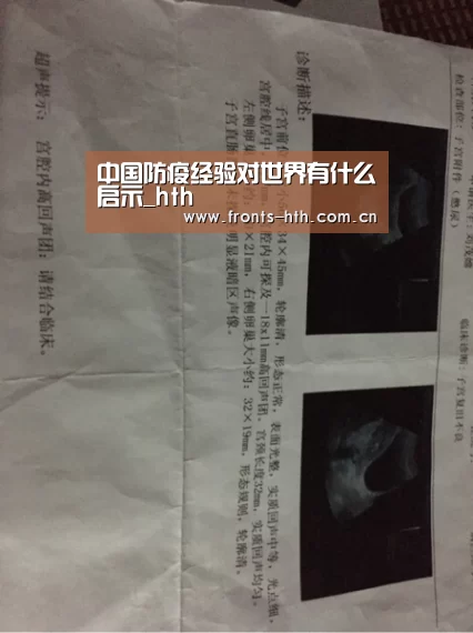 中国防疫经验对世界有什么启示_hth(图3)